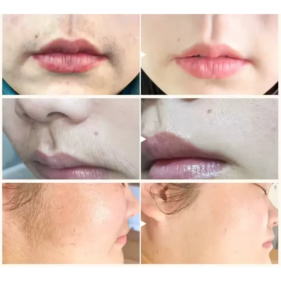 Bigote y rostro antes y después